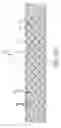 Fig. 56 - RETENTION DEVICES, LATTICES AND RELATED SYSTEMS AND METHODS