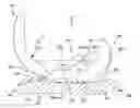 Fig. 01 - Posterior-stabilized total knee prosthesis