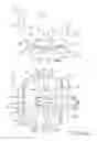 Fig. 05 - Posterior-stabilized total knee prosthesis