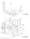 Fig. 07 - Posterior-stabilized total knee prosthesis
