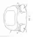 Fig. 05 - Prothesis for the replacement of a posterior element of a vertebra