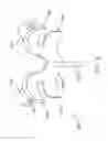 Fig. 09 - Prothesis for the replacement of a posterior element of a vertebra