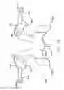 Fig. 14 - Prothesis for the replacement of a posterior element of a vertebra