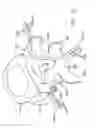 Fig. 16 - Prothesis for the replacement of a posterior element of a vertebra
