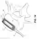 Fig. 13 - STABILIZED EXPANDABLE INTERVERTEBRAL SPACER