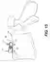 Fig. 14 - STABILIZED EXPANDABLE INTERVERTEBRAL SPACER