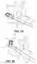 Fig. 24 - STABILIZED EXPANDABLE INTERVERTEBRAL SPACER