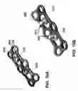 Fig. 24 - Surgical plate systems