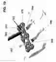 Fig. 27 - Surgical plate systems