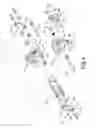 Fig. 05 - Prosthetic knee joint with buffering and braking effects