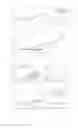 Fig. 15 - Prosthesis or orthosis comprising a hinge joint system for functionally assisting, enhancing and/or replacing a hinge joint of a human or animal subject