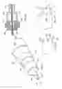 Fig. 09 - Methods of implanting a prosthesis