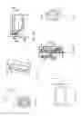 Fig. 13 - Methods of implanting a prosthesis