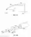 Fig. 23 - Methods of implanting a prosthesis