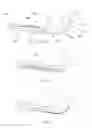 Fig. 24 - Methods of implanting a prosthesis