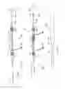 Fig. 05 - Methods of implanting a prosthesis and treating an aneurysm