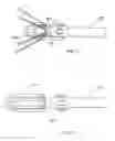 Fig. 11 - Methods of implanting a prosthesis and treating an aneurysm