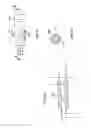 Fig. 15 - Methods of implanting a prosthesis and treating an aneurysm
