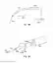 Fig. 23 - Methods of implanting a prosthesis and treating an aneurysm