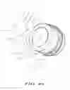 Fig. 25 - Methods of implanting a prosthesis and treating an aneurysm