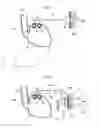 Fig. 04 - Method and instrument for treating obesity