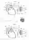 Fig. 12 - Method and instrument for treating obesity