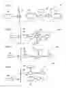 Fig. 18 - Method and instrument for treating obesity