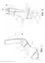 Fig. 02 - Orthotic system