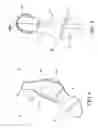 Fig. 08 - Orthotic system