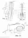 Fig. 14 - Patient restraint system and methods for assisting a caregiver with patient restraint