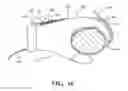 Fig. 16 - Patient restraint system and methods for assisting a caregiver with patient restraint