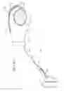 Fig. 17 - Patient restraint system and methods for assisting a caregiver with patient restraint