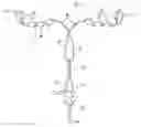 Fig. 01 - Intrauterine device with controlled copper ion elution