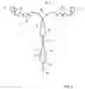 Fig. 04 - Intrauterine device with controlled copper ion elution
