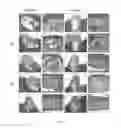 Fig. 08 - METHODS, KITS, AND COOLING DEVICES FOR DISRUPTING FUNCTION OF ONE OR MORE SEBACEOUS GLANDS