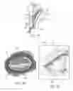Fig. 02 - Dry eye treatment systems