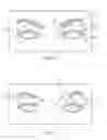 Fig. 07 - Dry eye treatment systems