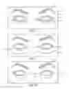 Fig. 08 - Dry eye treatment systems