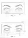 Fig. 09 - Dry eye treatment systems