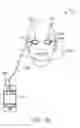 Fig. 22 - Dry eye treatment systems