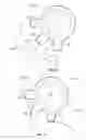 Fig. 34 - Intraocular delivery devices and methods therefor