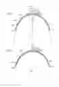 Fig. 03 - Negative pressure wound closure devices and methods