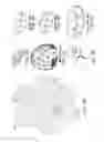 Fig. 04 - Negative pressure wound closure devices and methods