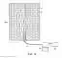 Fig. 09 - Negative pressure wound closure devices and methods