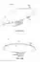 Fig. 16 - Negative pressure wound closure devices and methods