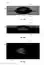 Fig. 32 - Compressive oxygen diffusive wound dressings