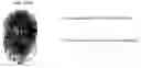 Fig. 01 - Clitoral Stimulation Apparatus
