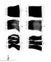 Fig. 02 - Hair Coloring Composition Comprising One or More Acrylate Monomers
