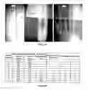Fig. 30 - Method for the Production of Commercial Nanoparticle and Microparticle Powders