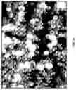 Fig. 02 - System and method for delivering protease inhibitors